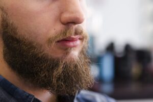 Beard Hair Transplant in Dubai