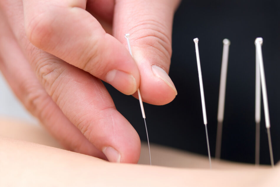 Redmond Acupuncture Supports Fertility & IVF Success Rates