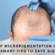 scalp micropigmentation cost