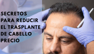 trasplante de cabello precio