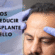 trasplante de cabello precio