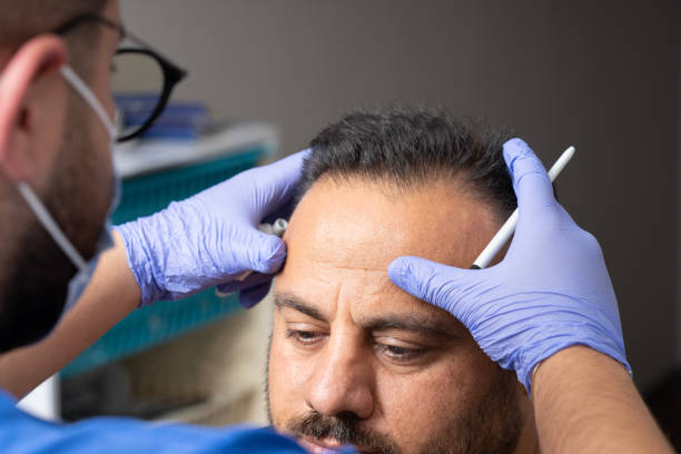 تكلفة زراعة الشعر في أبوظبي