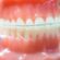 Achieve a Perfect Smile with Invisalign in Jonesboro, AR