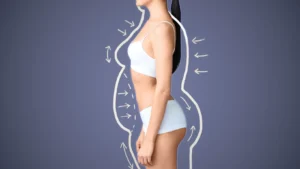 Body Contouring in Islamabad