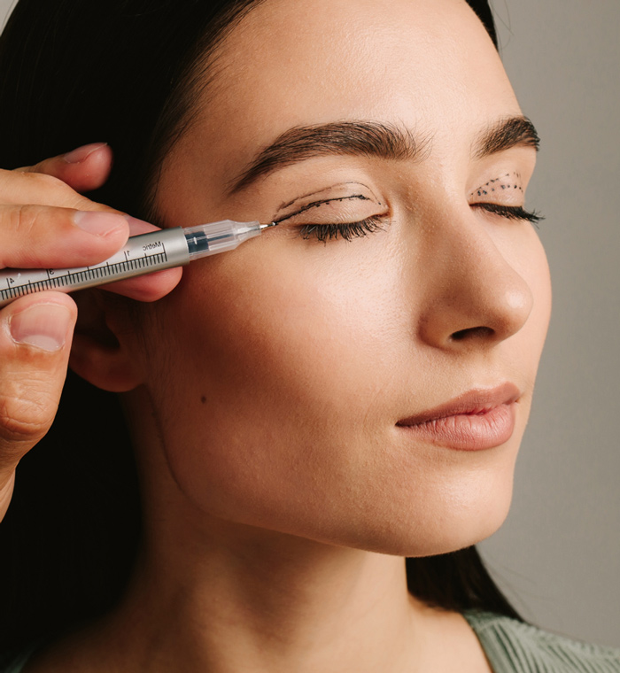 Blepharoplasty Dubai