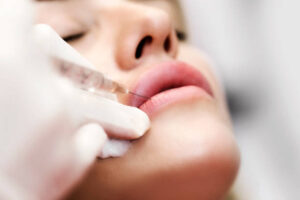 Can Lip Fillers Make You Look Younger Instantly