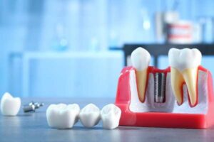 Dental