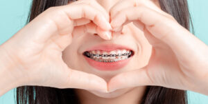 Dental Braces in Islamabad