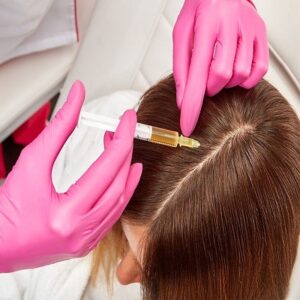 Exosomes Hair Therapy In Islamabad