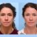 How Thread Lift Treatments in Dubai Can Transform Your Look