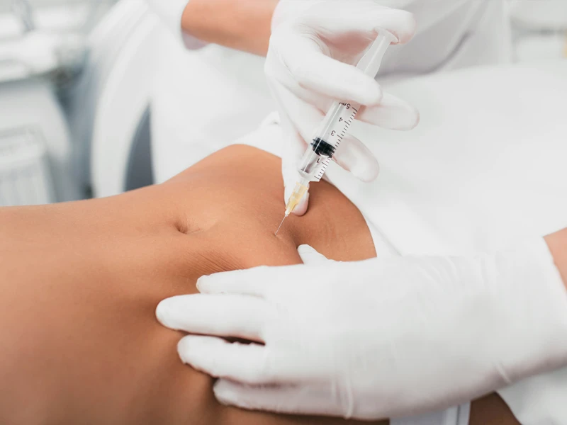 How Does Aqualyx Injection Compare to CoolSculpting