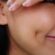 How Does Dimple Creation Surgery Work