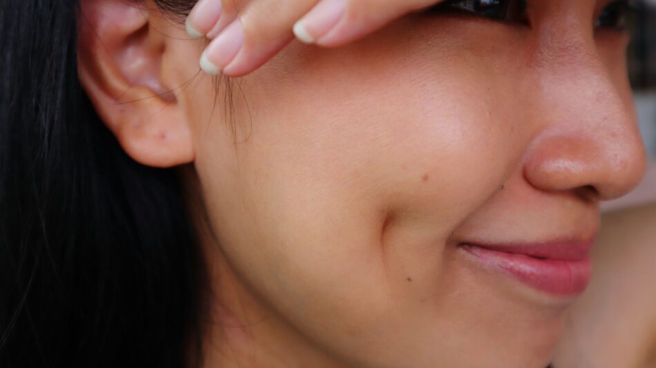 How Does Dimple Creation Surgery Work