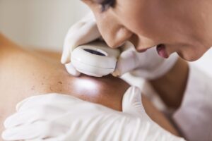 How Long Are Wait Times for Dermatologist?