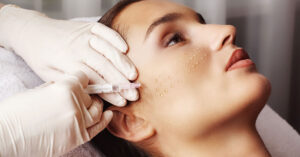 How Soon Can You See Results from Mesotherapy?