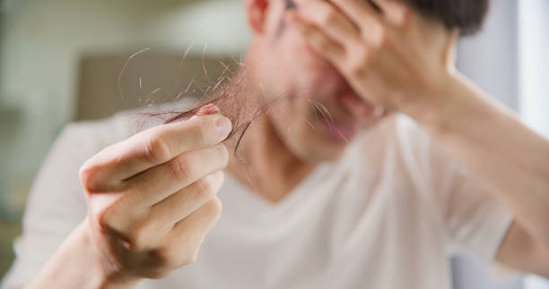 Is Alopecia Areata Treatment Worth Trying?