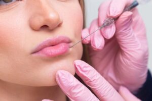 Juvederm filler Dubai