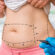 Liposuction Surgery Simple Way to Slim Down
