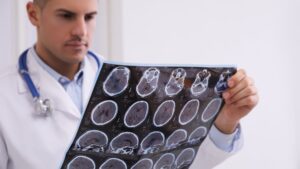 MRI Glendale