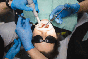 Minimally Invasive Facial Slimming