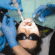 Minimally Invasive Facial Slimming