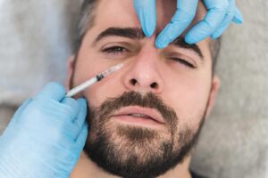 Non-Surgical Nose Lifting with Botox