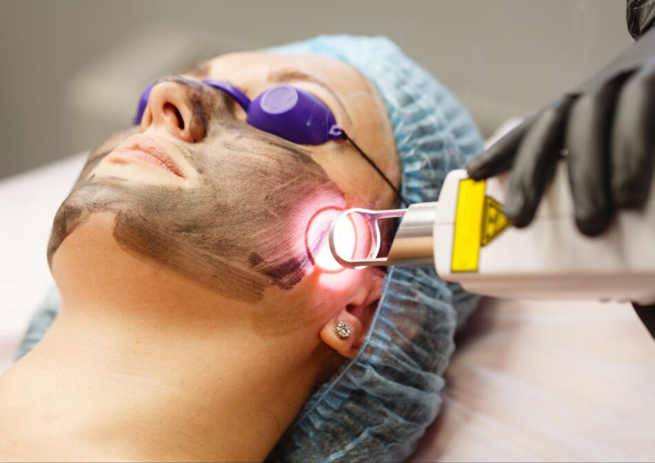 PICO Laser Treatment In Islamabad