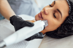 Pain-Free Skin Lifting Treatments with RF Technology