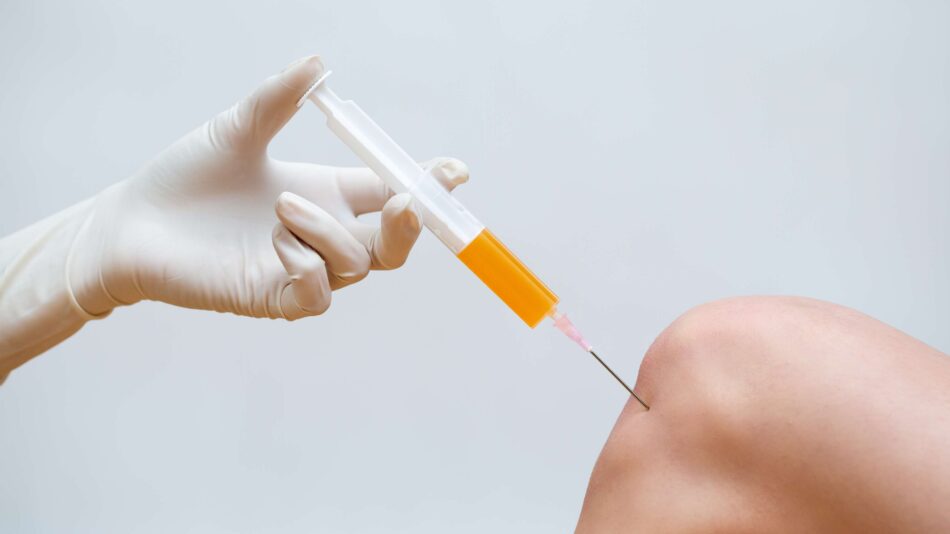 Safe and Natural Knee Pain Relief With PRP