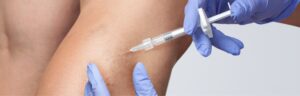 Sclerotherapy Quick and Effective Procedure