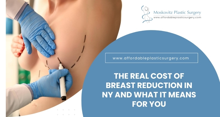 Breast Reduction Surgery NY, Cost of Breast Reduction​ New York