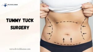 Tummy Tuck Surgery in Delhi