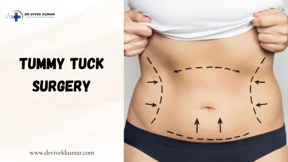 Tummy Tuck Surgery in Delhi