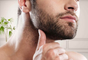 What Techniques Are Used in Beard Hair Transplant?