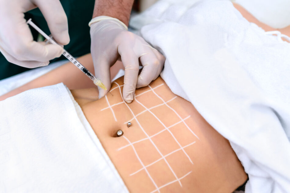 What to Expect After Fat Dissolving Injections?