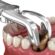 What to Expect from a Tooth Extraction in Tampa, FL
