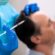 Why Choose Stem Cell Hair Transplant