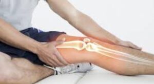 bone cancer image