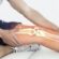 bone cancer image