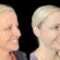Redefine Your Features with the Best Plastic Surgeon in Dubai for Botox