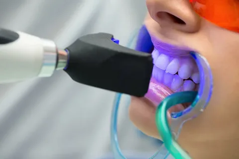 teeth whitening Cypress TX