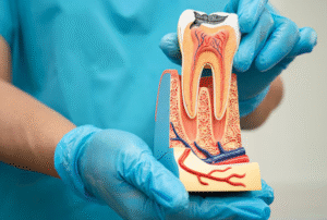 louisville ky root canal