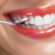Smile Bright: Dentures in Nampa and Wisdom Tooth Healing