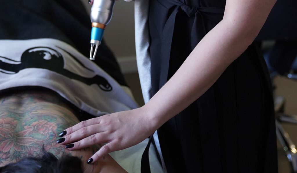 ⁠best tattoo removal boston
