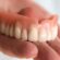 Get Your Smile Back Fast: Teeth in a Day and Same Day Dentures in West Houston