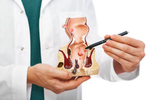 هل علاج البواسير فعال حقًا؟