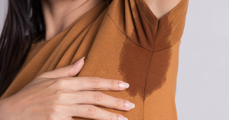 Hyperhidrosis Treatment in Dubai