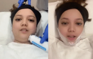 Fat Melting Injection in Dubai