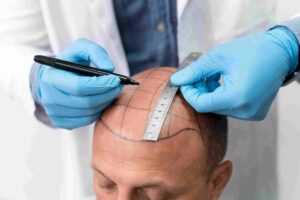 Hair Transplant Clinic in Dubai