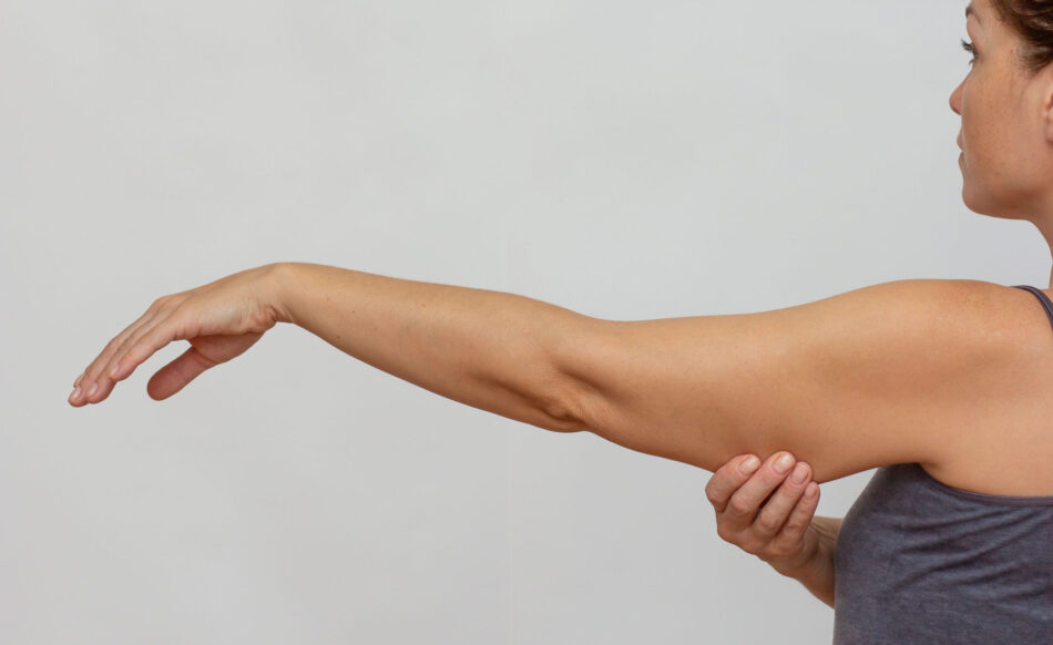 Arm Lift Surgery in Dubai